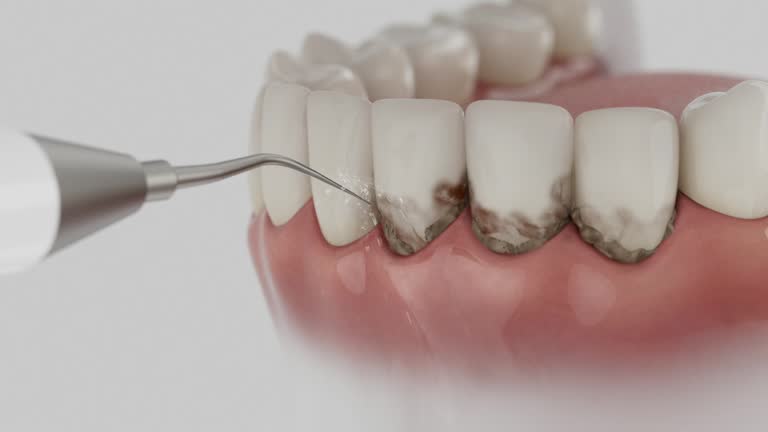 Reliable Dental Implants contractor in Riddle, OR by Smile Center Dentistry